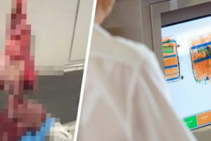 Таможенники аэропорта были шокированы, когда обнаружили в чемодане у туристов пищеварительную систему