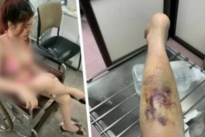 На известной достопримечательности начались нападения: укушенных туристов массово колют уколами и накладывают швы